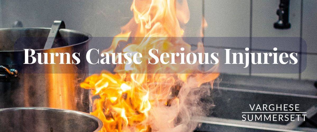 burn injury lawyer | Varghese Summersett burn injury lawyer