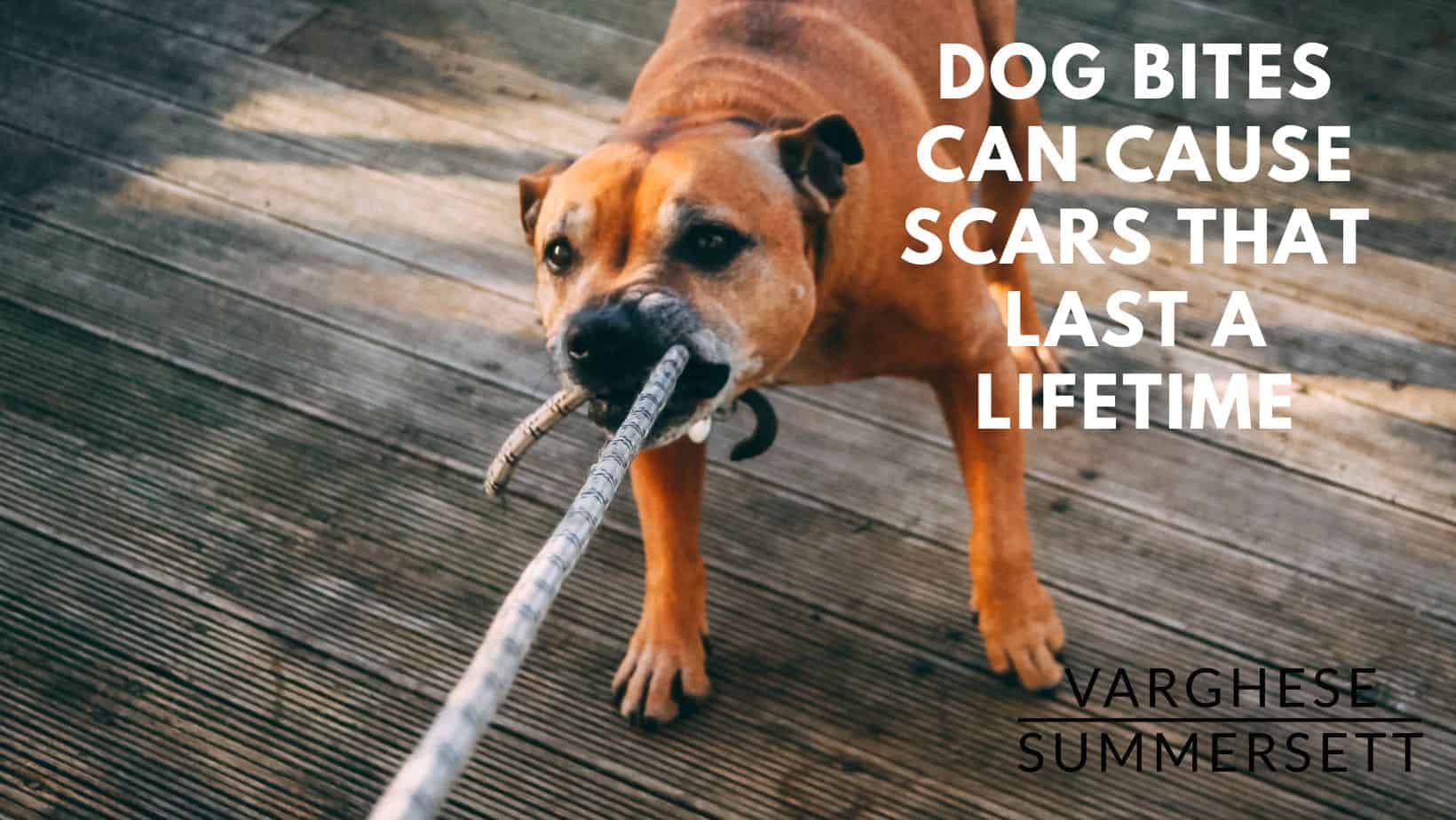 dog bite lawyer 1 | Varghese Summersett dog bite