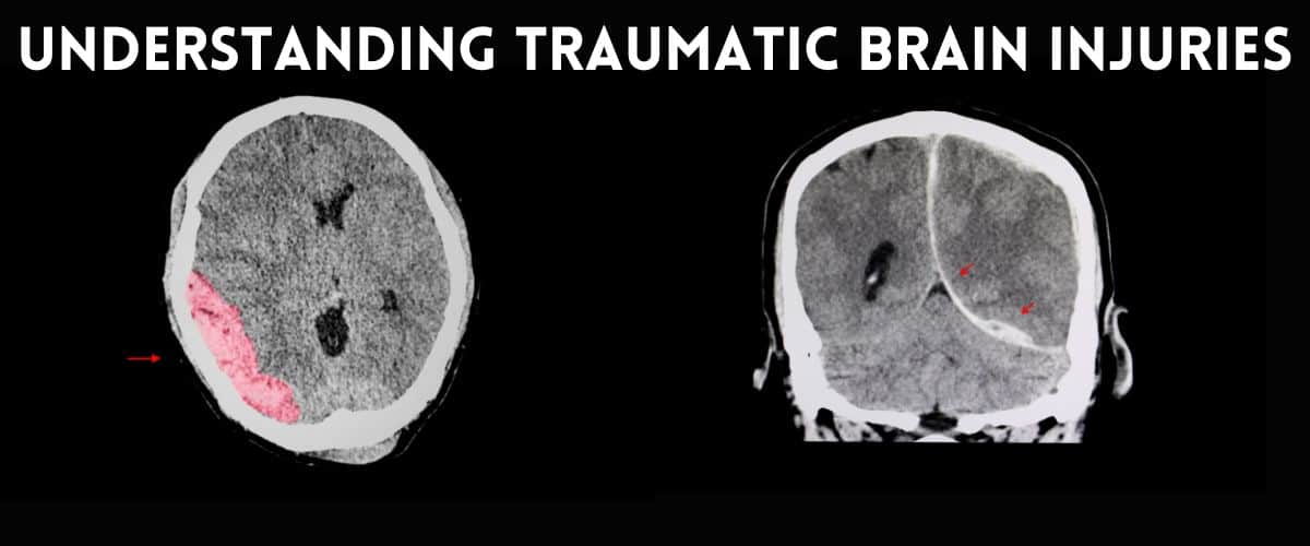 traumatic brain injuries