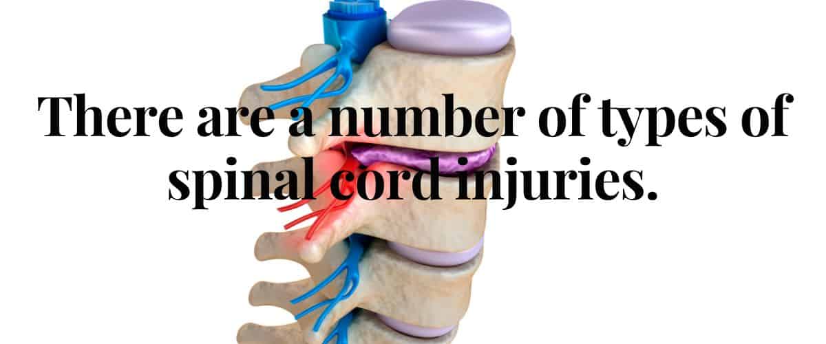 types spinal cord injuries 1 | Varghese Summersett types of spinal cord injuries